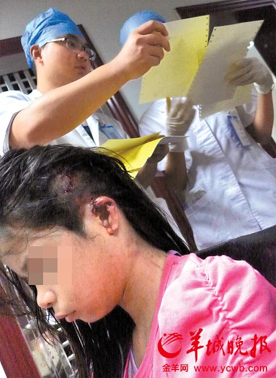 受傷的11歲女孩頭發(fā)被卷入扶梯，耳朵被嚴(yán)重拉傷，需手術(shù)。