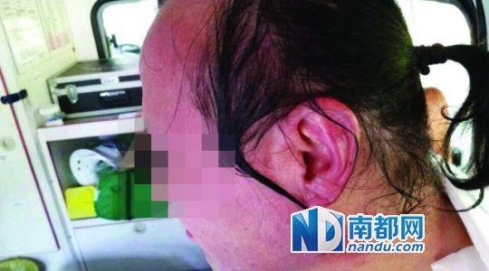 涉事教師遭熱水潑臉后的照片。