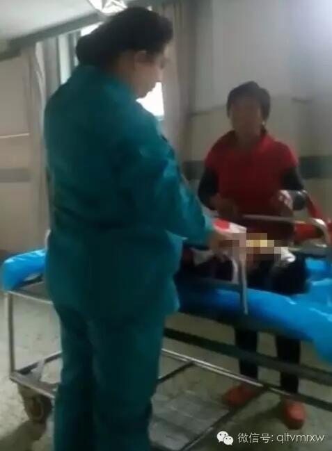 涵涵爸爸告訴《每日新聞》記者：“沒想到是熱水，大人也沒看，一時(shí)疏忽，掉進(jìn)去了。抱出來的時(shí)候這個(gè)皮已經(jīng)掉了。”
