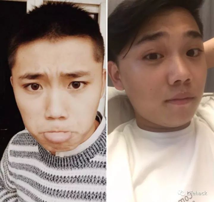 長胖20斤，臉型怎么變？這些例子看完扎心了！