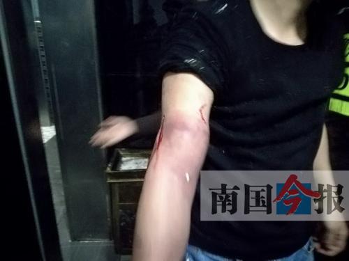 覃先生手臂被卡的部位受傷流血，所幸傷勢(shì)無大礙。 通訊員 王建民 攝