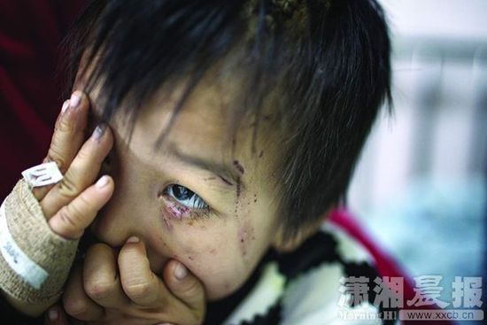 1月13日，湖南省兒童醫院，4歲的源源用手蒙住了眼睛。
