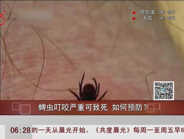 蜱蟲叮咬嚴重可致死如何預防？