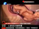 中國剖腹產率超高成隱憂